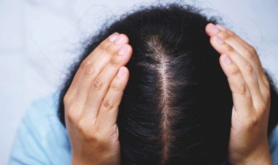 L’impact psychologique de la perte de cheveux chez les femmes